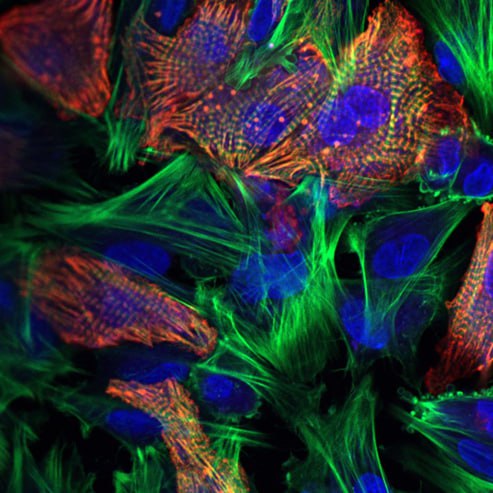 Культура кардиомиоцитов. Фото: Айгуль Низамиева