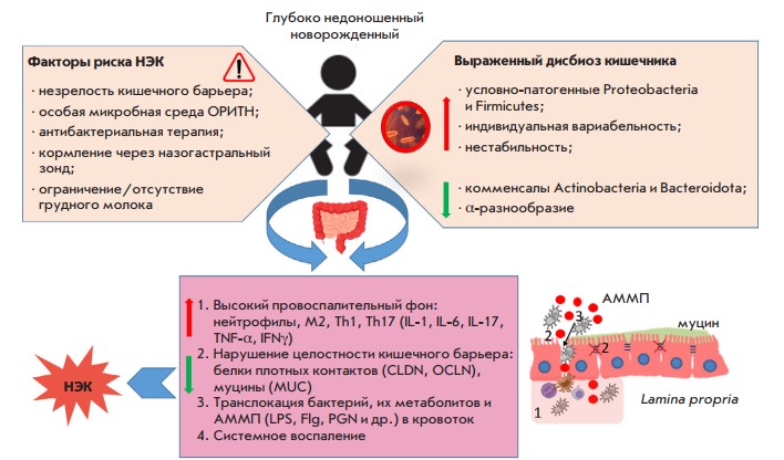 Схема патогенеза некротизирующего энтероколита у глубоко недоношенных детей. Источник: Acta Naturae