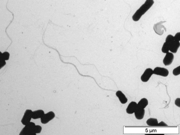 Клетки бактерии Exiguobacterium sibiricum. Источник: BMC Genomics Architecture of thermal adaptation in an Exiguobacterium sibiricum strain isolated from 3 million year old permafrost: A genome and transcriptome approach | BMC Genomics | Springer Nature Link